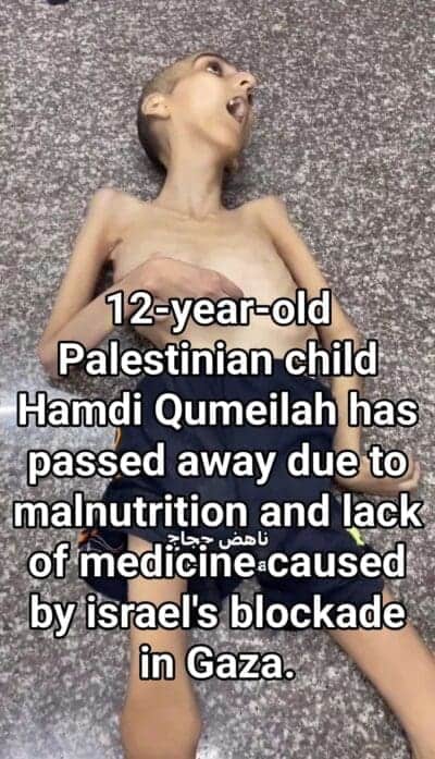 img 6083 e1729710666539 Children shot gaza. Palestinian boy who died of starvation.
