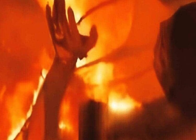 img 7868 Israel’s blockade of gaza and effects of the occupation. Here, a young man burning alive in gaza